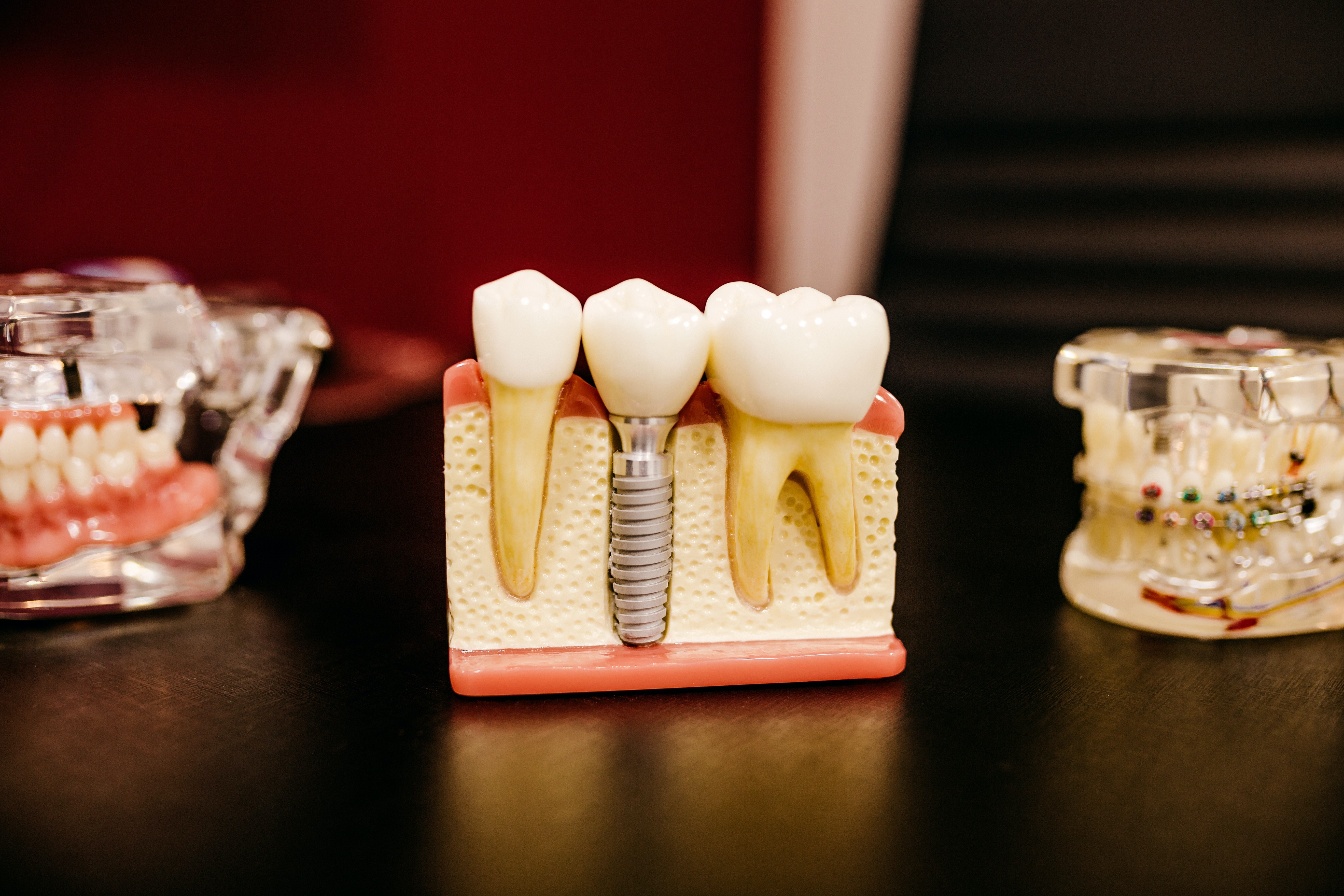 Chirurgia stomatologiczna na Podhalu – wybierz sprawdzony gabinet dentystyczny